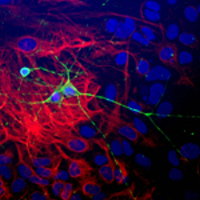 Dissociated cell culture of a neonatal mouse brain showing β-Tubulin 3 (green staining) of neurons.