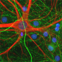 Neonatal rat cortical neurons cultured for 14-21 days.