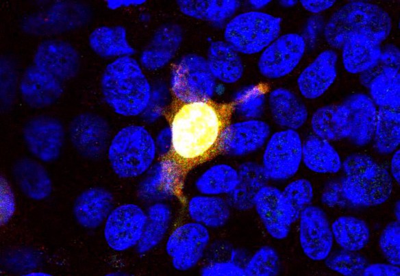 Transfected Hek293 cells overexpressing the N-terminal 1-608 amino acids of S. pyogenes Cas9 .