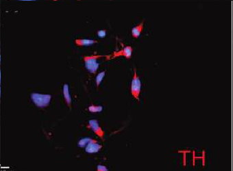 TH (tyrosine hydroxylase, an excitatory neuronal marker) staining of STEMEZ(TM) hNP1 Human Neural Progenitors.  doi:10.1089/ten.tea.2009.0155.