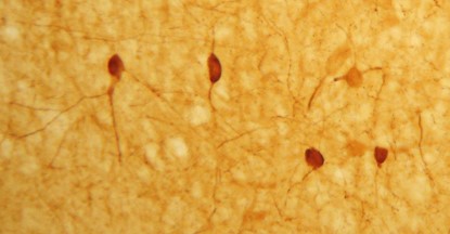 IHC image of neurons staining for the calbindin in the rat cortex.